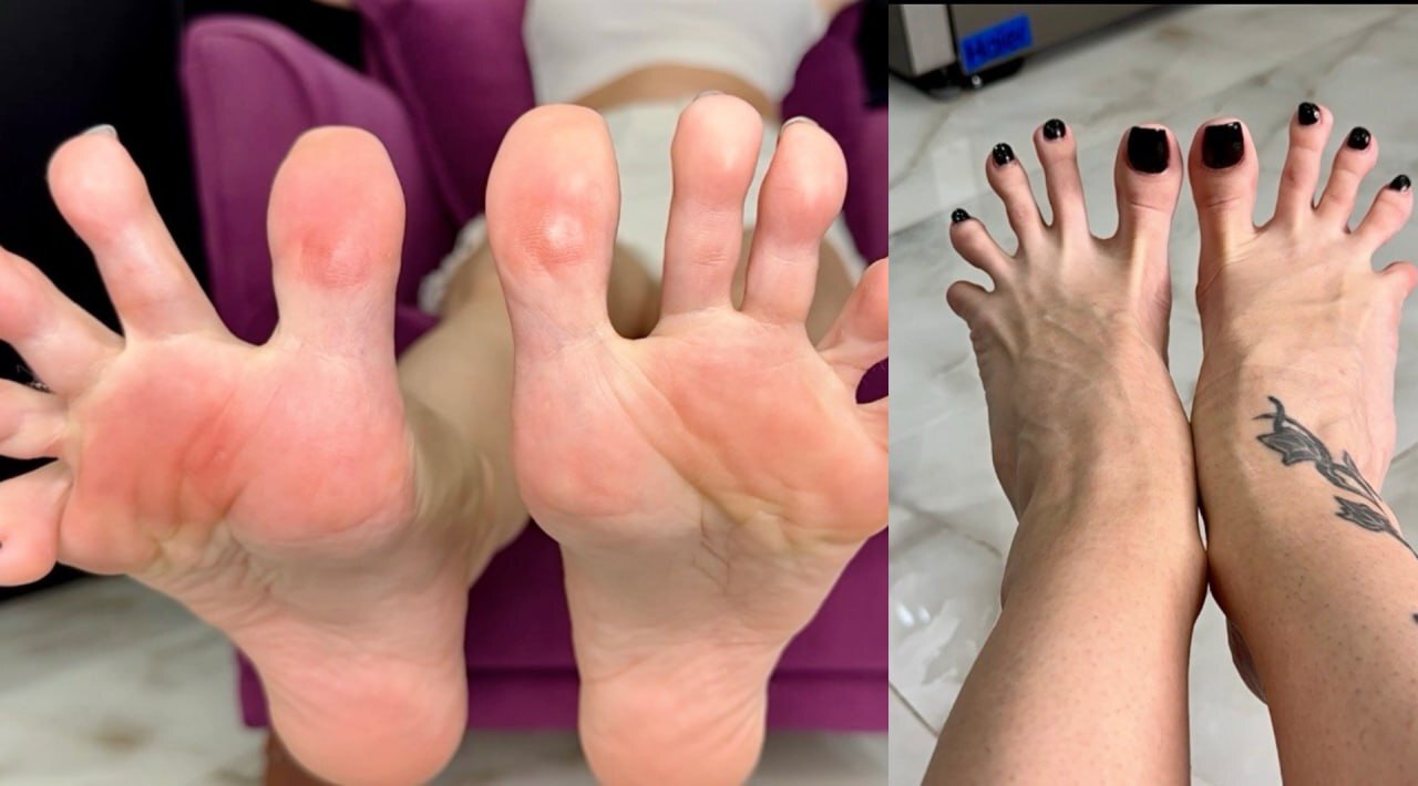 Long toes spreading, toe spread close ups in two different angles, bare feet with black toenails