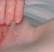 ANALRING: MEINE ANALRING FOTZE !!! Download