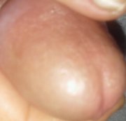 STECHER094: Eichel gestreichelt Download